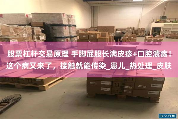 股票杠杆交易原理 手脚屁股长满皮疹+口腔溃疡！这个病又来了，接触就能传染_患儿_热处理_皮肤